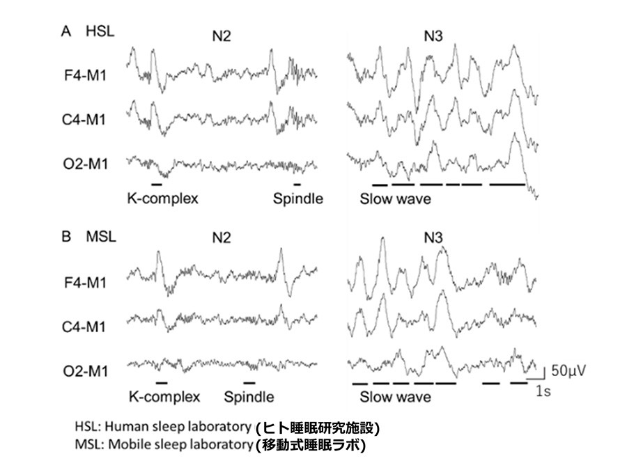 図2 ヒト睡眠研究施設（上）と移動式睡眠ラボ（下）でのPSG検査結果の一部（睡眠脳波）。各睡眠段階において、同等に特徴波形が確認される