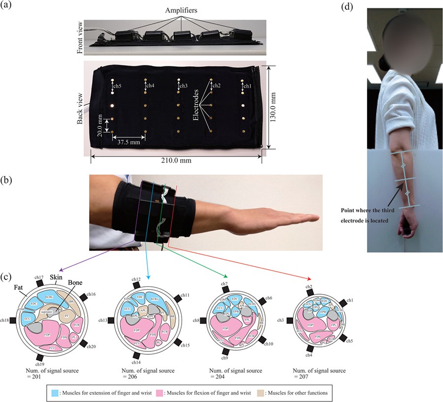 New myoelectric system for sensing deep muscle movement using multiple electromyographs.